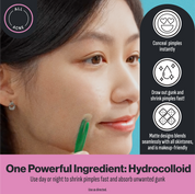 Oxy 8-in-1 Pimple Patches